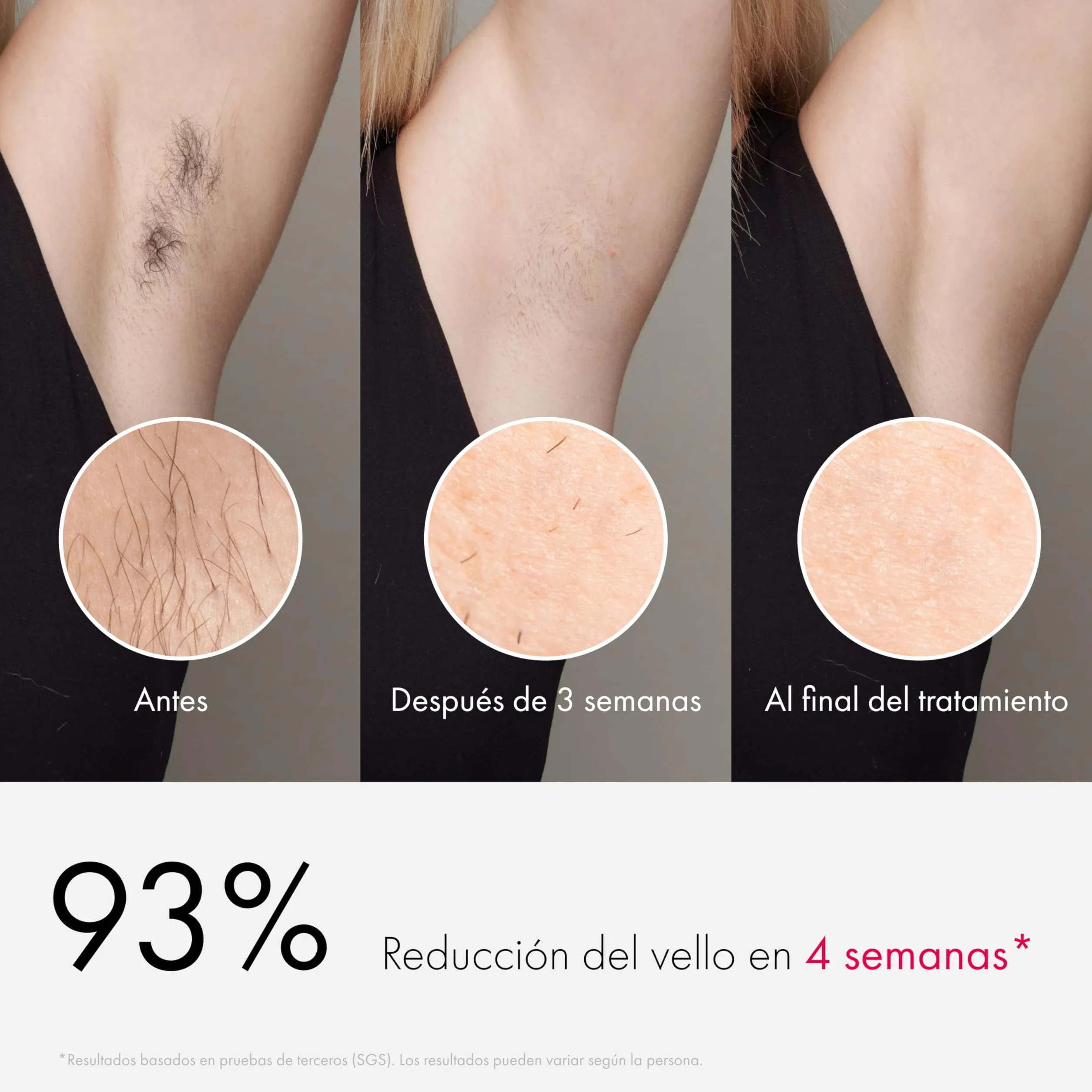 Ulike Air 3 Deluxe Depiladora Luz Pulsada para Mujer y Hombre con Esterilizador UV